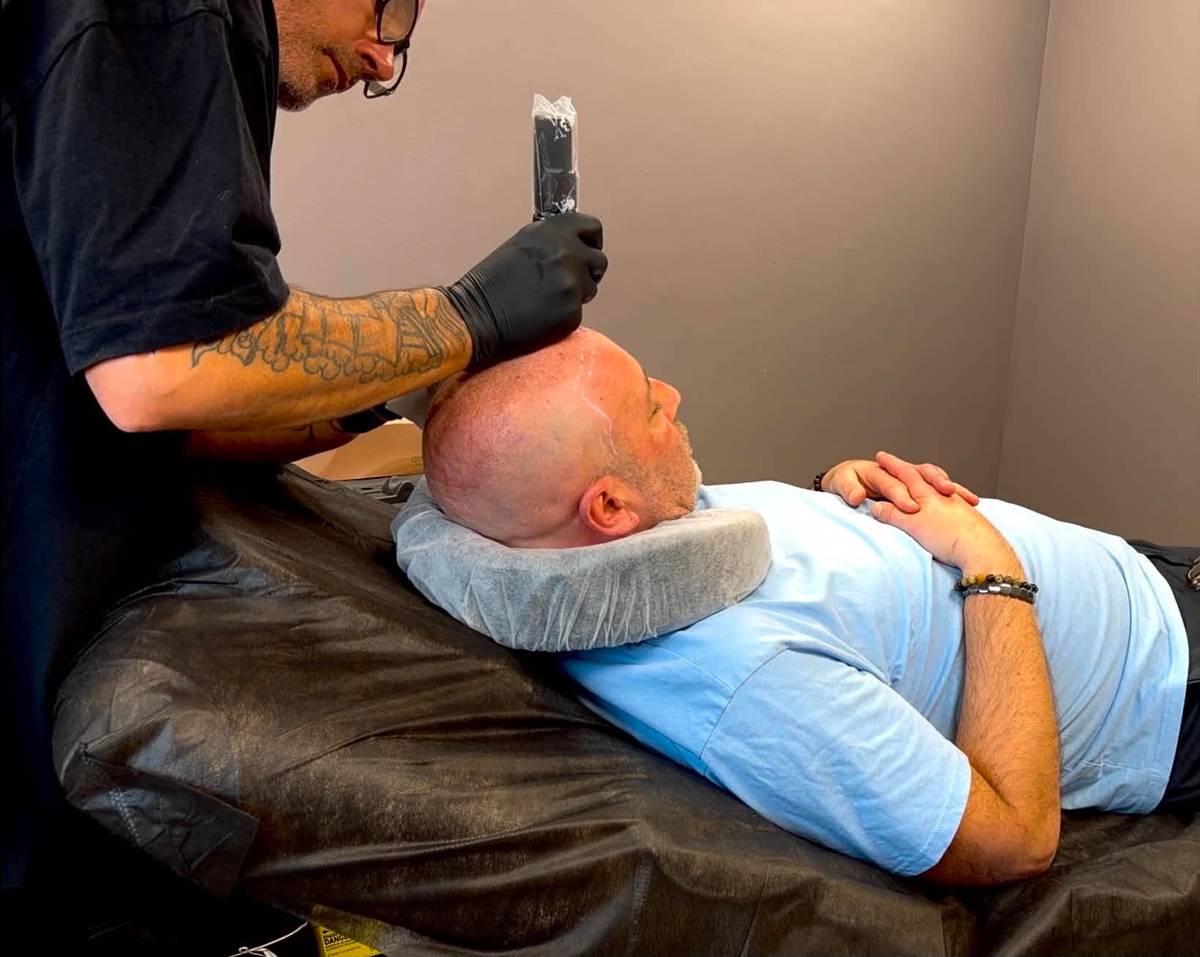Stephen carrying out a scalp micropigmentation touch-up at Kennedy SMP Studio