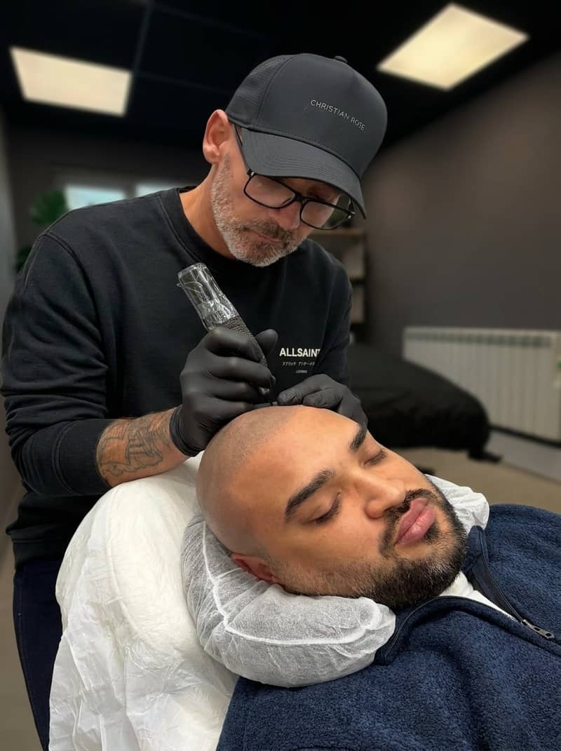 Stephen Kennedy carrying out a scalp micropigmentation treatment on a client's hairline at the Haverhill studio
