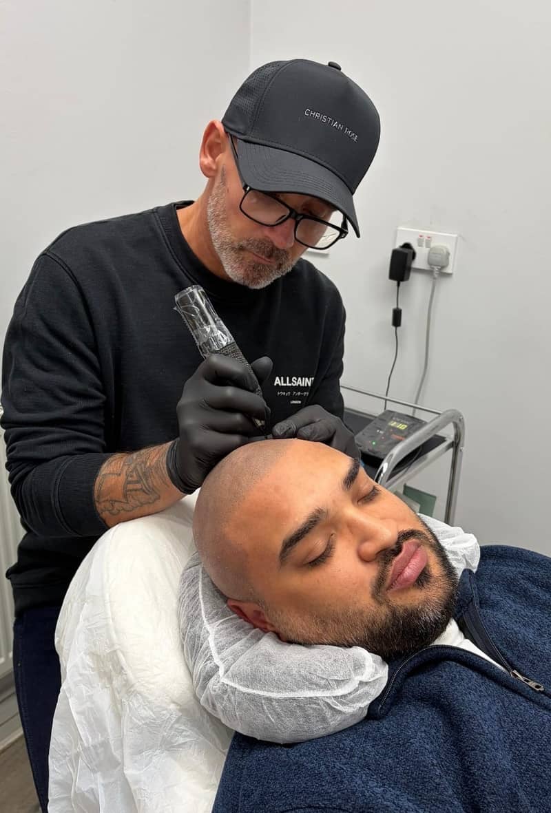 A client relaxing during a scalp micropigmentation session at Kennedy SMP Studio in Haverhill